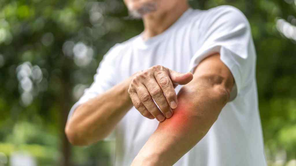 A person in a white shirt touches their forearm, which is highlighted with a red area to indicate pain or inflammation.