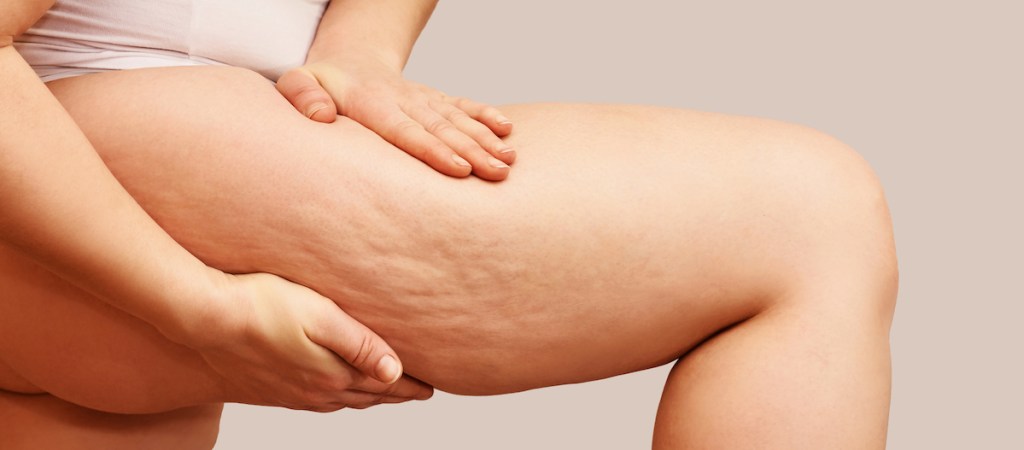 person's thigh displaying cellulite