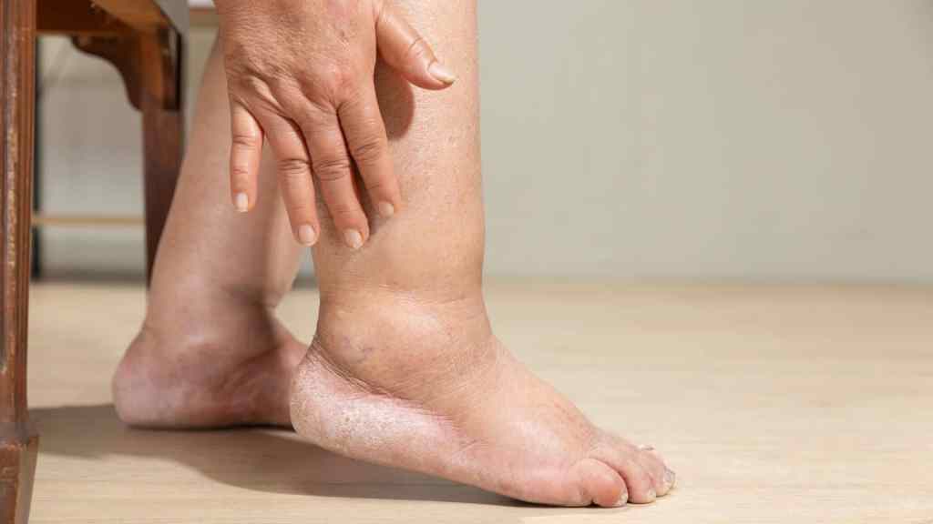 A person touches their dry, scaly lower leg and foot while seated on a wooden floor.